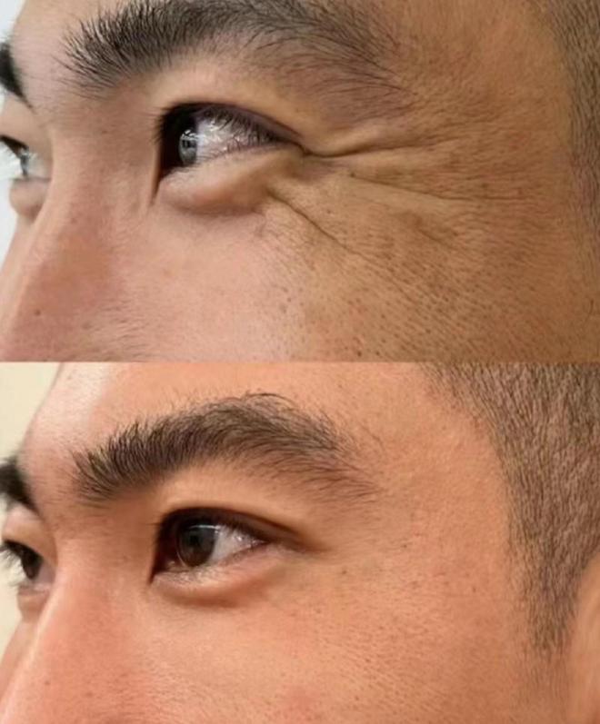 肤品推荐这几款口碑不可错过OG真人游戏抗皱紧致的护(图3)