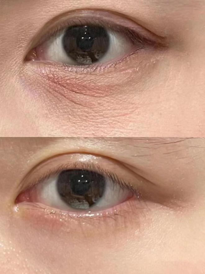 牌子好？年度抗老眼霜决赛圈熬夜总结OG网站25岁男士眼霜去眼袋哪个(图10)
